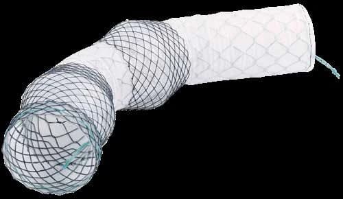 Taewoong Niti-S BETA esophageal stent, curved covered stent with flared ends