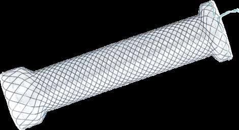 Taewoong Niti-S CERIVICAL esophageal stent, low-profile covered stent for cervical placement