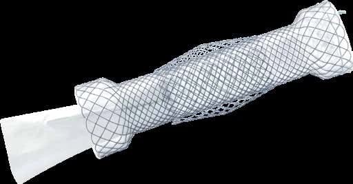 Taewoong Niti-S DOUBLE esophageal stent with anti-reflux valve membrane at the distal end